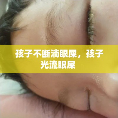 孩子不断淌眼屎，孩子光流眼屎 